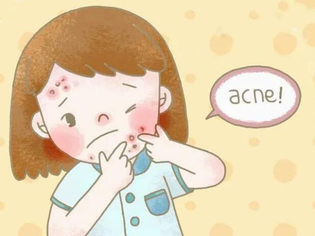 雪卡伊加盟